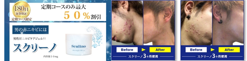 �X�N���[�m���T�C�g